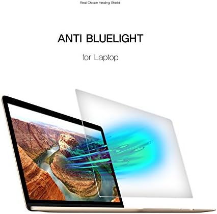 Healingshield Ekran Koruyucu Göz Koruma Anti Uv Mavi Ray Film Dell Laptop için Uyumlu XPS 13 9370 Dokunmatik