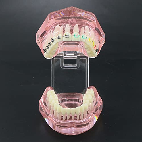 Diş Modeli, Diş Ortodonti Tutucu Gösteri ile Metal Seramik Öz-ligating Parantez için Diş Çalışma Modeli