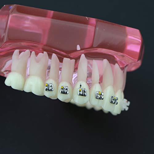 Diş Diş Çalışma Modeli Ortodontik Metal ve Seramik Parantez İle M3003 Pembe